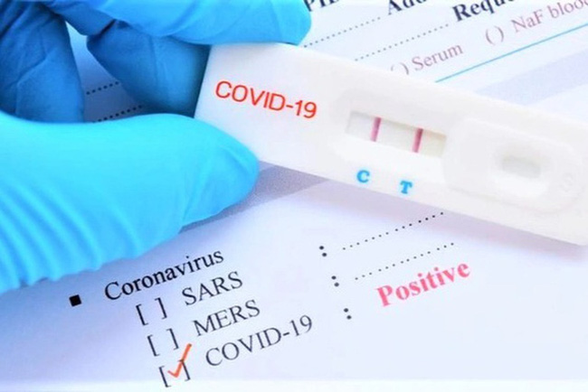 Điều chỉnh giá xét nghiệm SARS-CoV-2 giảm khoảng 30% so với giá hiện hành 