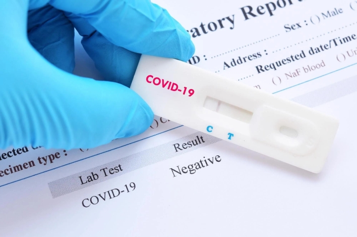 Cảnh giác với Natri Azua - chất độc có trong test nhanh COVID-19 