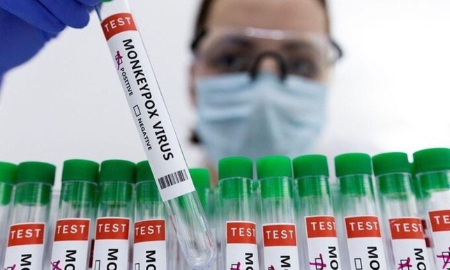 Có nên tiêm vắc xin ngừa đậu mùa khỉ? 